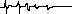 Copy (2) of Ekg.gif (127 bytes)